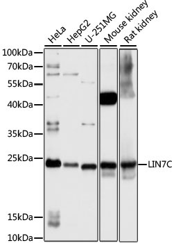 LIN7C Rabbit Polyclonal Antibody