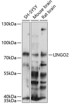 LINGO2 Rabbit Polyclonal Antibody