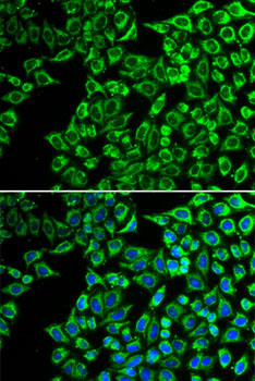 LIPC Rabbit Polyclonal Antibody