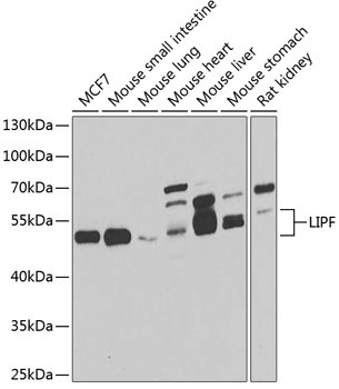 LIPF Rabbit Polyclonal Antibody