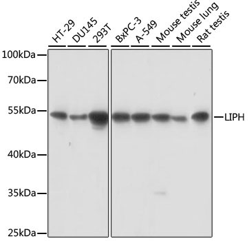 LIPH Rabbit Polyclonal Antibody
