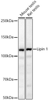 Lipin 1 Rabbit Polyclonal Antibody