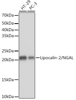 Lipocalin-2/NGAL Rabbit Monoclonal Antibody