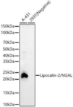 Lipocalin-2/NGAL Rabbit Monoclonal Antibody