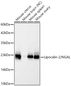 Lipocalin-2/NGAL Rabbit Monoclonal Antibody