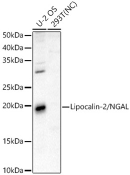 Lipocalin-2/NGAL Rabbit Polyclonal Antibody