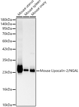 Lipocalin-2/NGAL Rabbit Polyclonal Antibody