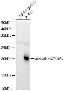 Lipocalin-2/NGAL Rabbit Polyclonal Antibody