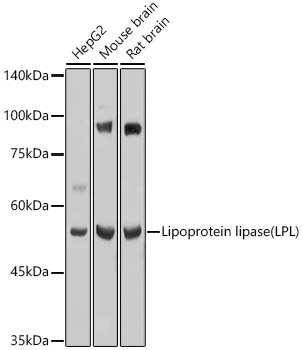 Lipoprotein lipase (LPL) Rabbit Polyclonal Antibody