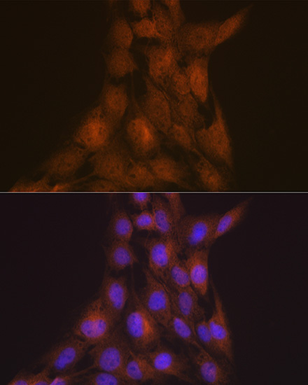 LIS1 Rabbit Monoclonal Antibody - Image 2