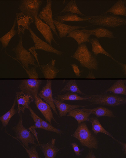 LIS1 Rabbit Monoclonal Antibody - Image 3