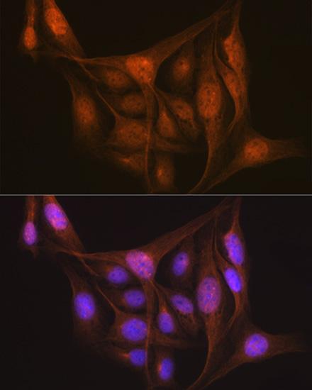 LIS1 Rabbit Monoclonal Antibody - Image 4