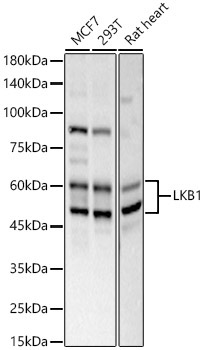 LKB1 Rabbit Polyclonal Antibody