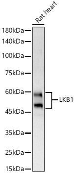 LKB1 Rabbit Polyclonal Antibody - Image 2
