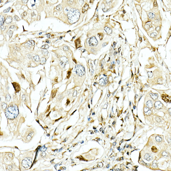 LKB1 Rabbit Polyclonal Antibody - Image 3
