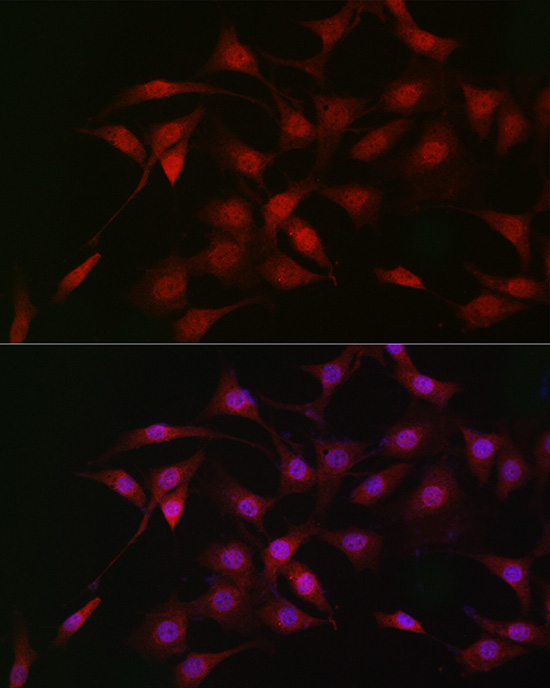 LKB1 Rabbit Polyclonal Antibody - Image 4