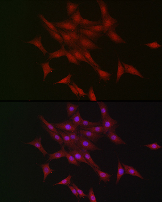 LKB1 Rabbit Polyclonal Antibody - Image 5