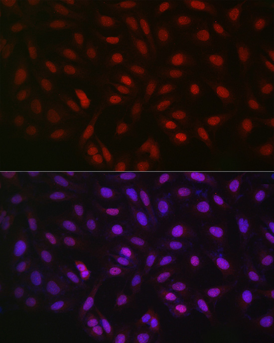 LKB1 Rabbit Polyclonal Antibody - Image 6