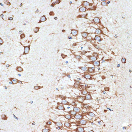 LMAN1 Rabbit Monoclonal Antibody - Image 2