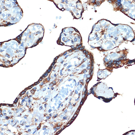 LMAN1 Rabbit Monoclonal Antibody - Image 4