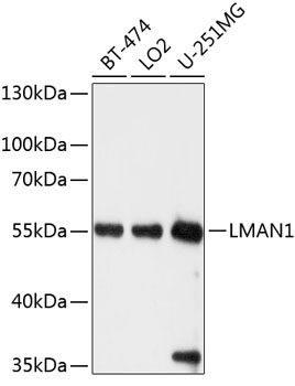 LMAN1 Rabbit Polyclonal Antibody
