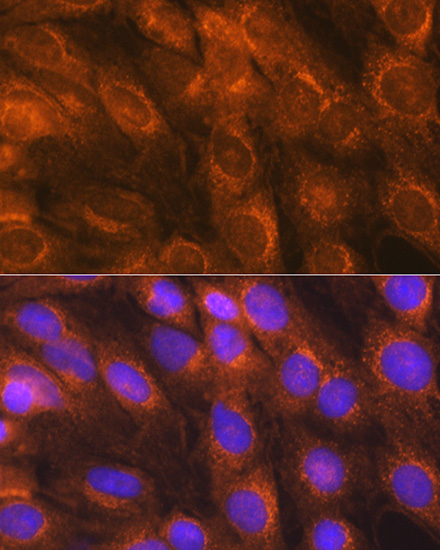 LMAN1 Rabbit Polyclonal Antibody - Image 2
