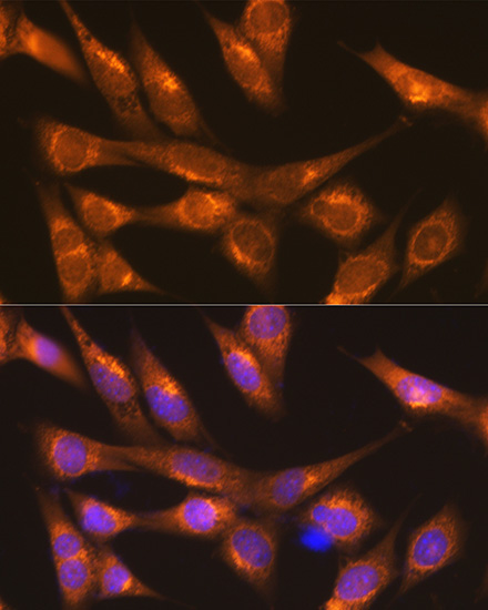 LMAN1 Rabbit Polyclonal Antibody - Image 3