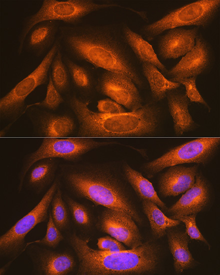 LMAN1 Rabbit Polyclonal Antibody - Image 4