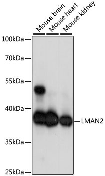 LMAN2 Rabbit Polyclonal Antibody