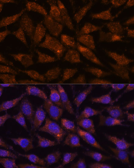 LMAN2 Rabbit Polyclonal Antibody - Image 2