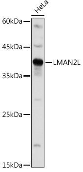 LMAN2L Rabbit Polyclonal Antibody