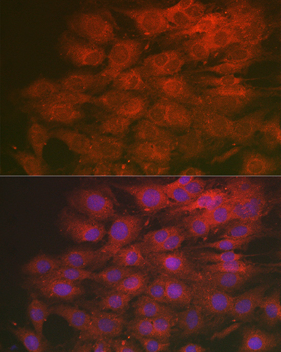 LMAN2L Rabbit Polyclonal Antibody - Image 2