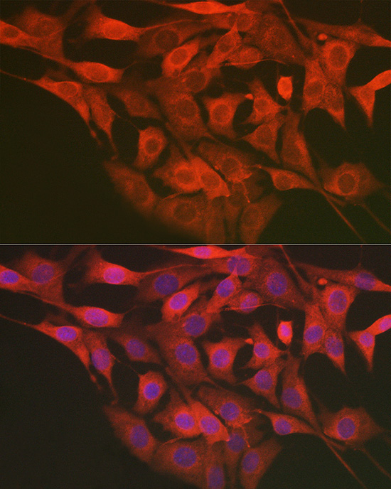 LMAN2L Rabbit Polyclonal Antibody - Image 3