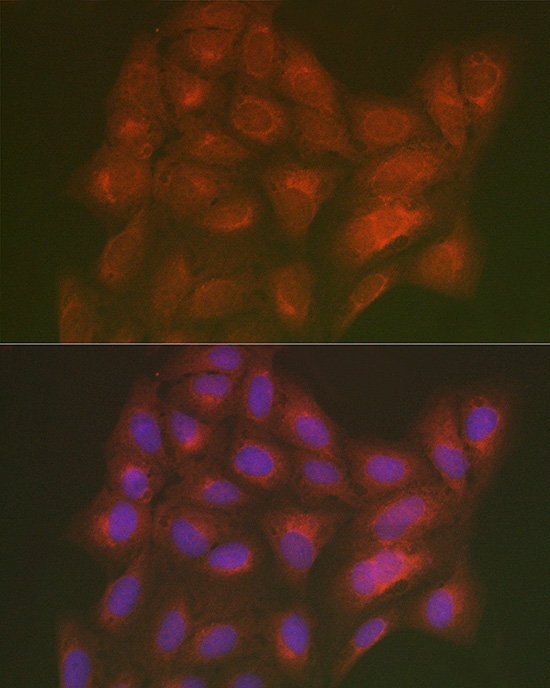 LMAN2L Rabbit Polyclonal Antibody - Image 4