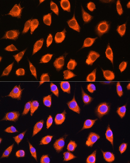 LMBRD1 Rabbit Polyclonal Antibody - Image 2