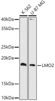 LMO2 Rabbit Monoclonal Antibody