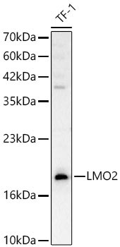 LMO2 Rabbit Polyclonal Antibody