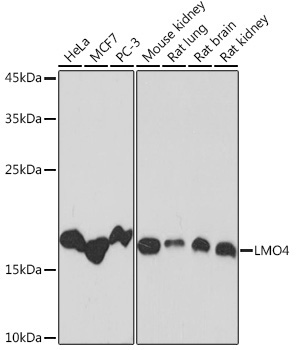 LMO4 Rabbit Monoclonal Antibody