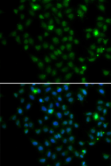 LMO4 Rabbit Polyclonal Antibody