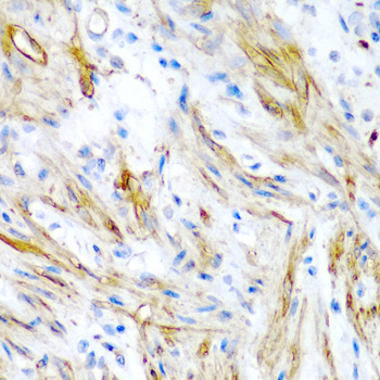 LMOD1 Rabbit Polyclonal Antibody