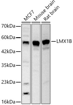 LMX1B Rabbit Polyclonal Antibody