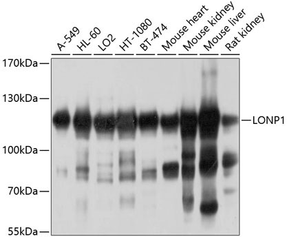 LONP1 Rabbit Polyclonal Antibody