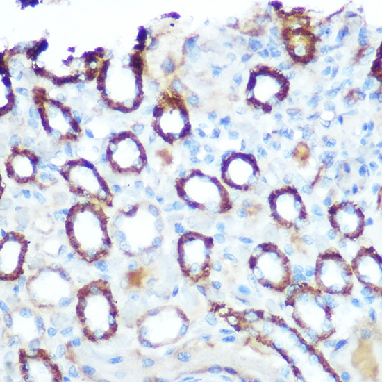 LONP1 Rabbit Polyclonal Antibody - Image 2