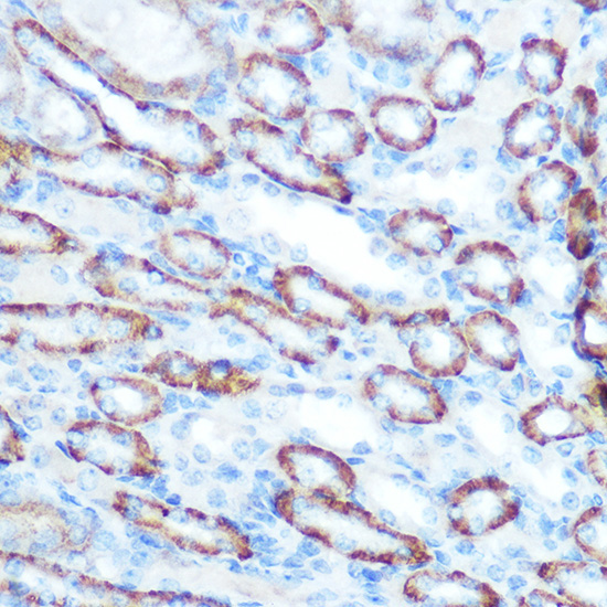 LONP1 Rabbit Polyclonal Antibody - Image 3