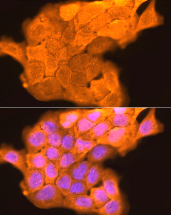 LORICRIN Rabbit Polyclonal Antibody - Image 2