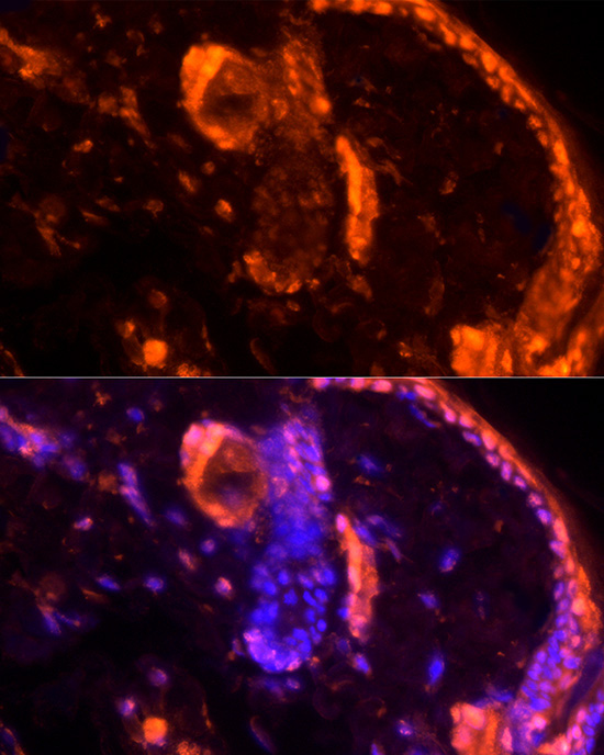LORICRIN Rabbit Polyclonal Antibody - Image 3