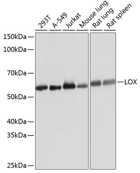 LOX Rabbit Monoclonal Antibody