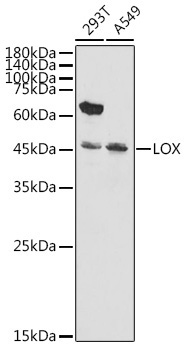 LOX Rabbit Polyclonal Antibody