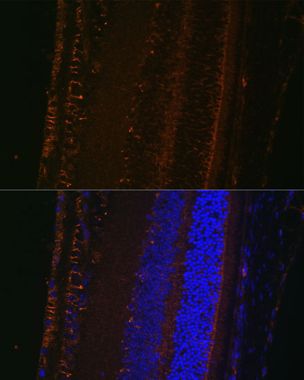LOXL1 Rabbit Polyclonal Antibody - Image 2