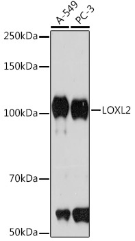 LOXL2 Rabbit Monoclonal Antibody